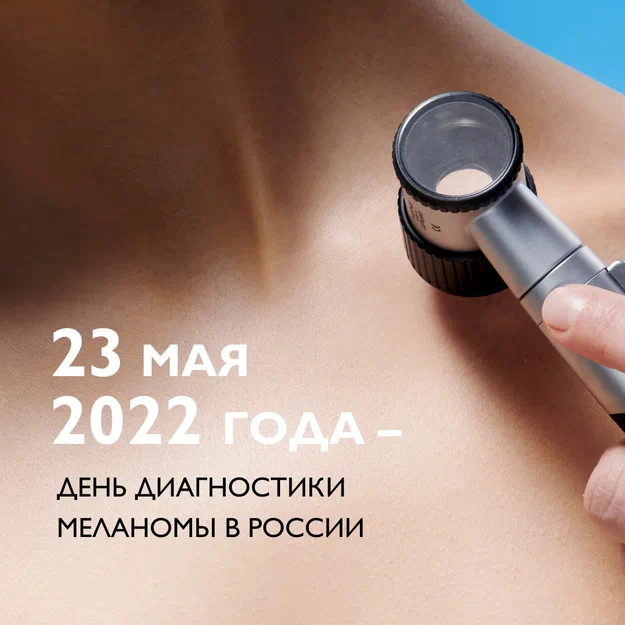 изображение 23 мая в клинике "Тринити" пройдет "день Меланомы", прием бесплатный - Клиника ТРИНИТИ - Москва 
